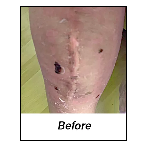 Knee_Before