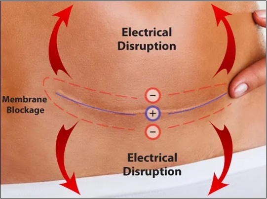 Scar_Electrical-Disruption-22